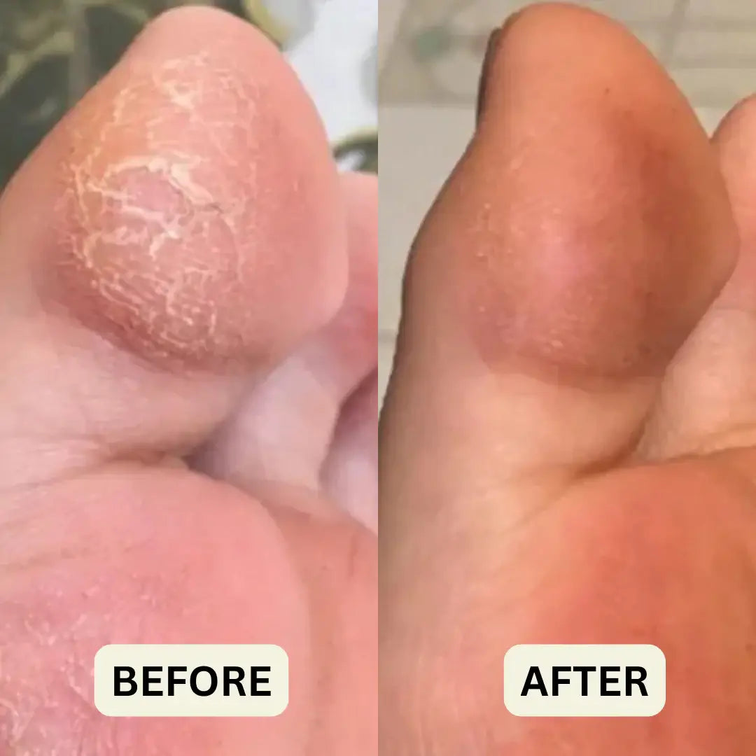 Honey Feet Relief Stick