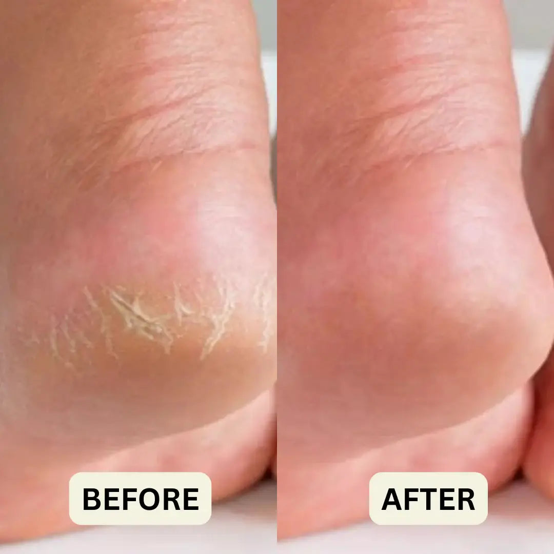 Honey Feet Relief Stick