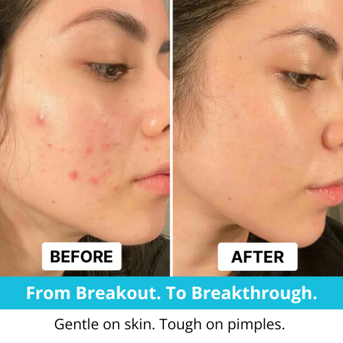 ClearSkin Healing Patch Roll