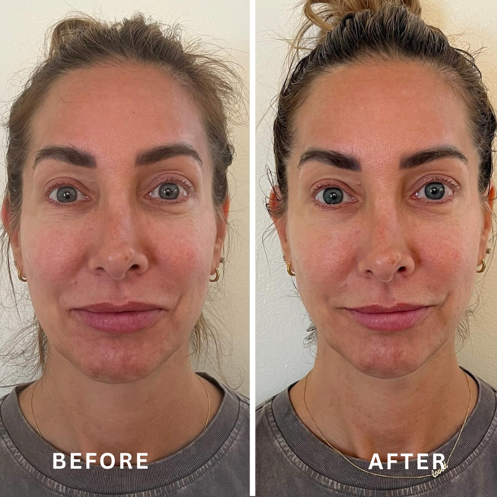 Lymphatic Contour Face Brush