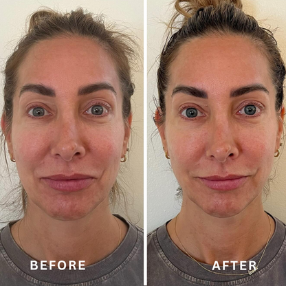 Lymphatic Contour Face Brush